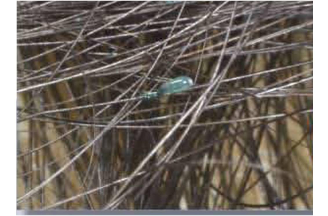 Lente colorée en bleu par le dispositif APAISYL DETECT LENTES.