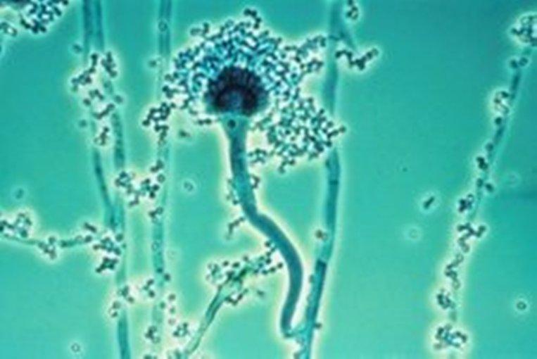 Aspergillus sp., présumé être Aspergillus fumigatus (© Wikimedia)