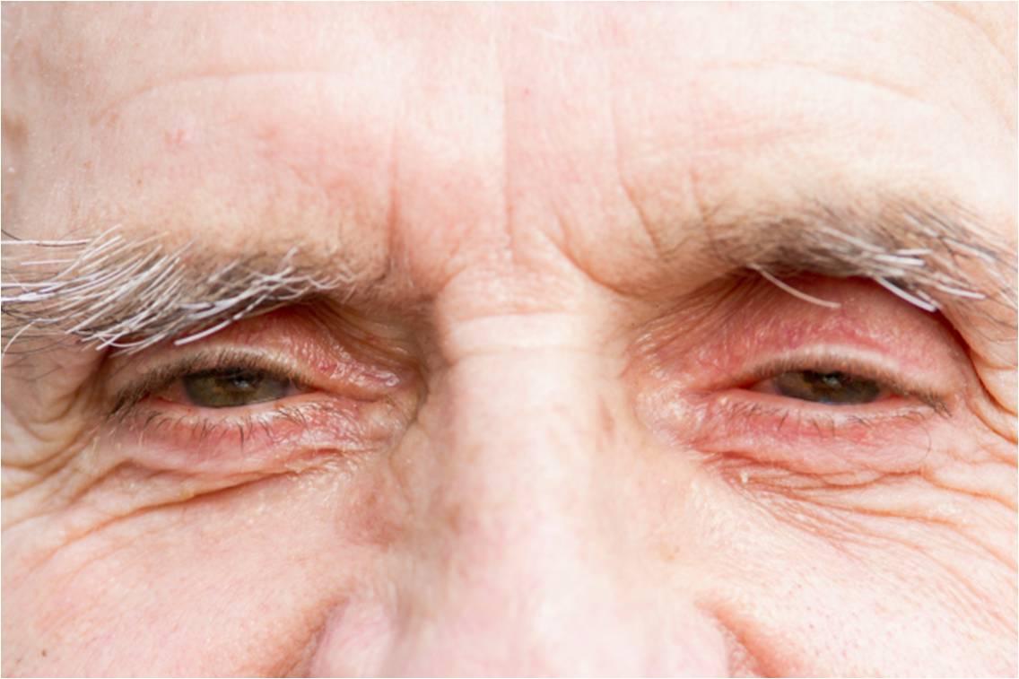 VISIODORON MALVA est une solution ophtalmique destinée aux yeux secs et irrités.